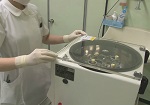 PRPF療法